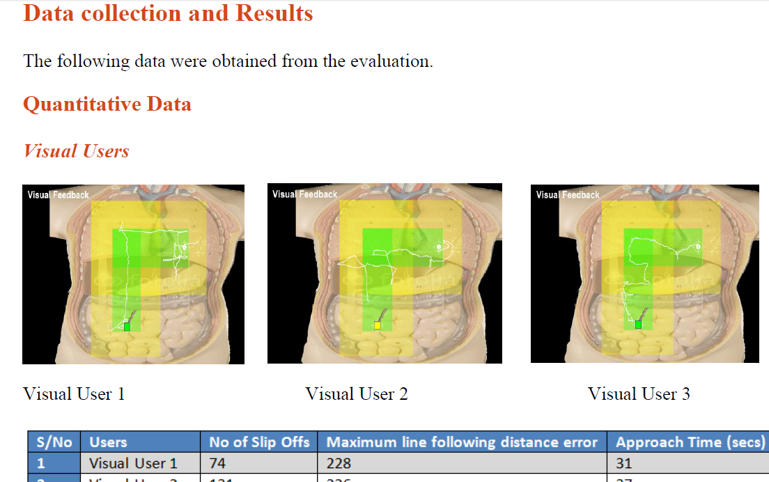 Haptics in Robotic Surgery